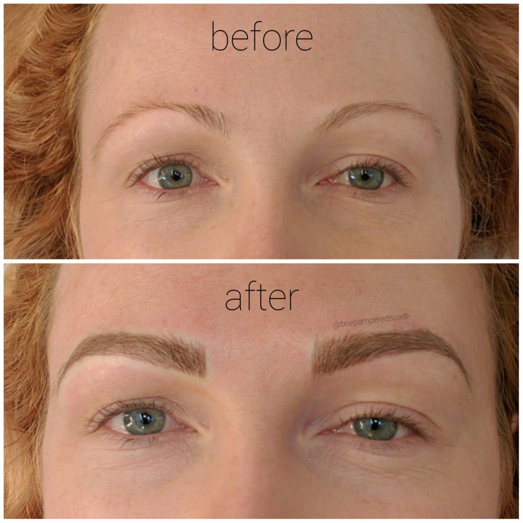 before after